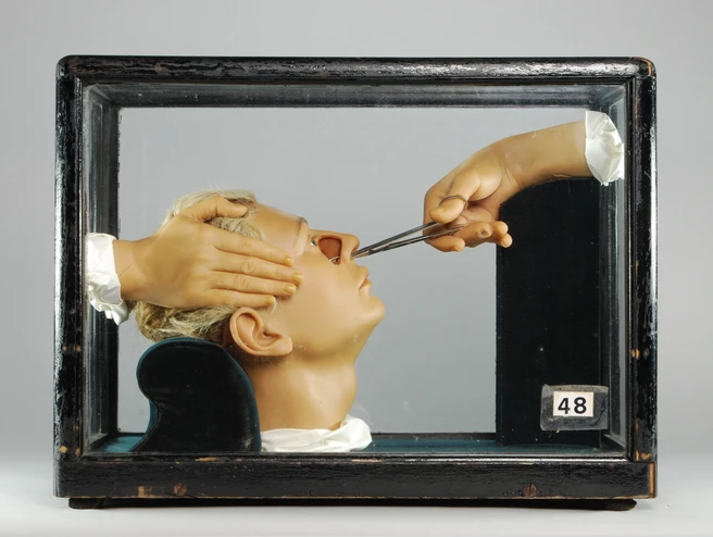 Anatomical wax model: „Die Operation des Nasenpolypen“ (DHMD 2011/27), Deutsches Hygiene-Museum Dresden - © J. Kreil